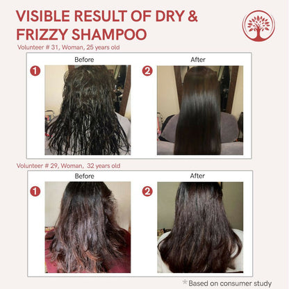 Ivory Natural Dry Rough Hair Shampoo For Dry, Frizzy, Unmanaged Hair