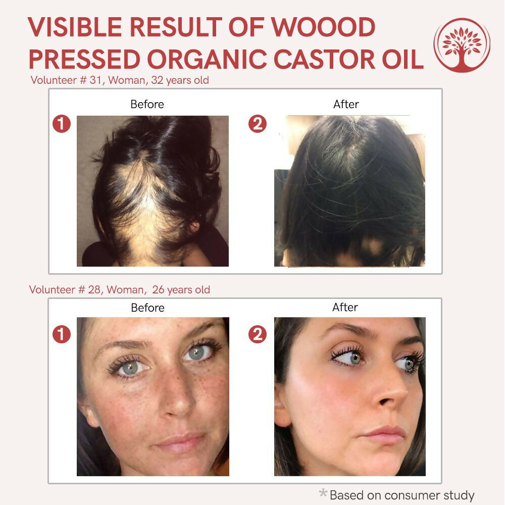 Ivory Natural Wood Pressed Organic Castor Oil For Healthy Skin & Hair Wellness